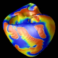 Multi-scale modeling and simulation of electrical patterns in the heart